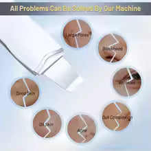 PureLift  Ultrasonic Blackhead Remover