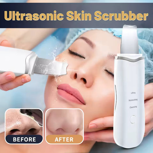 PureLift  Ultrasonic Blackhead Remover