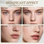 Facial Starter Kit Serum Set - Image 4